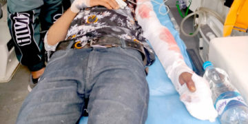 اونتی پورہ میں سڑک حادثہ میں دو ہلاک، 9 زخمی