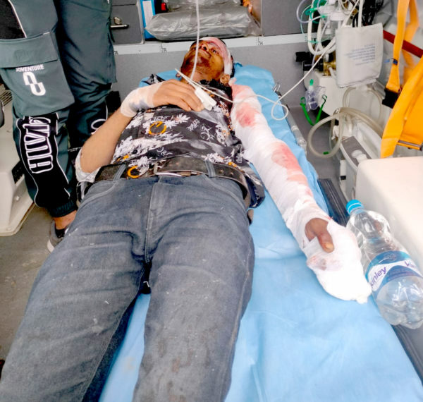 اونتی پورہ میں سڑک حادثہ میں دو ہلاک، 9 زخمی