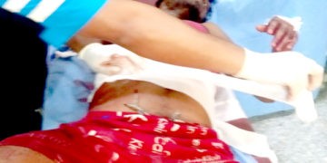 شوپیاں کے گاگرن گاوں میںمیں مشتبہ ملی ٹینٹوں کی فائرنگ، تین غیر مقامی مزدور زخمی